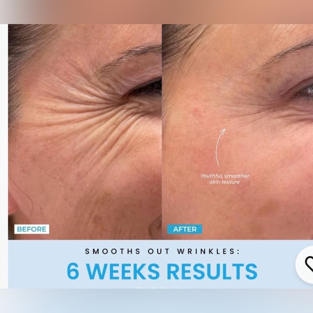 Liftlab 3 in 1 face and neck massager - Picture 3 of 7